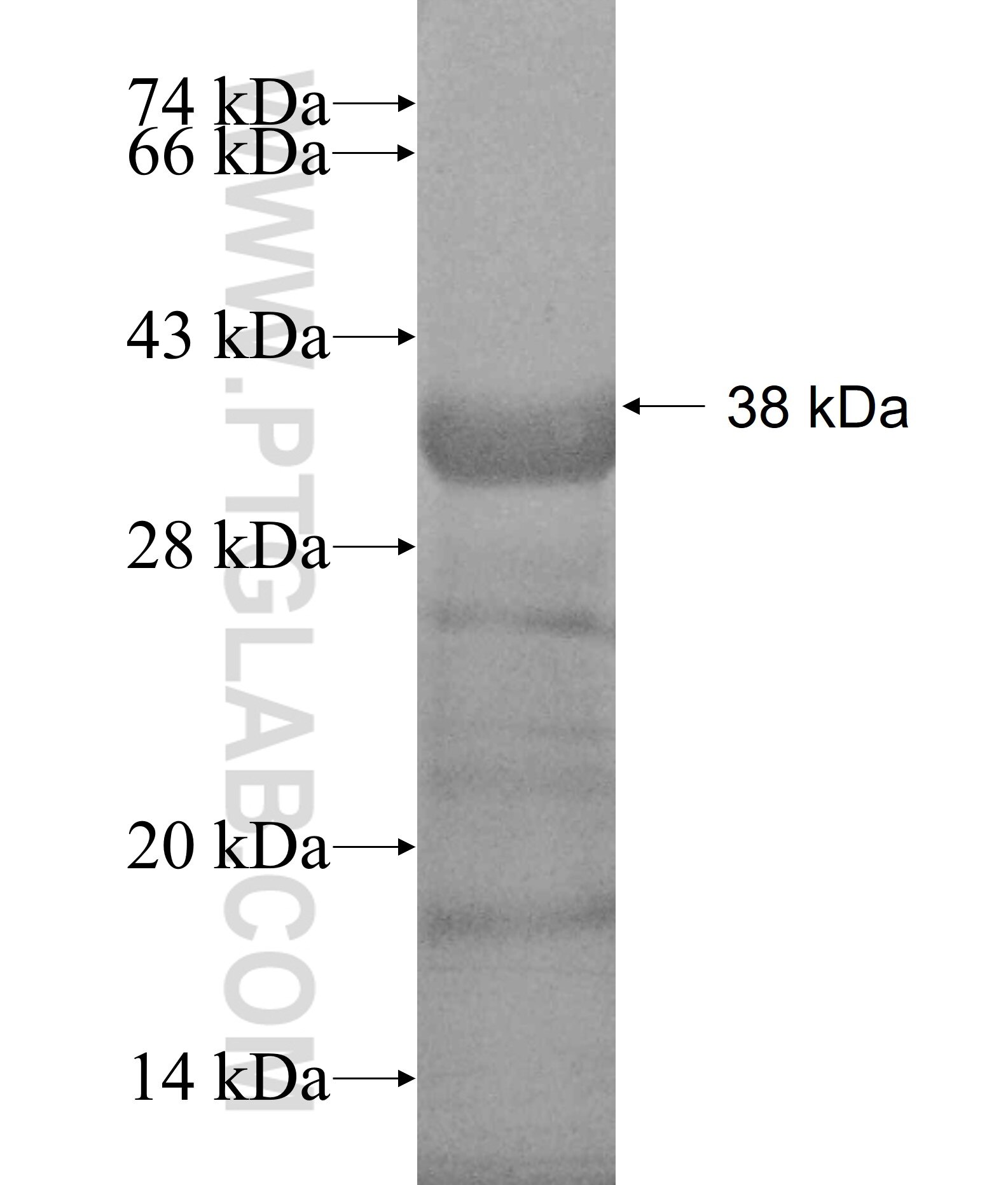 SMC4 fusion protein Ag19039 SDS-PAGE