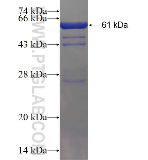 SMC4 fusion protein Ag19156 SDS-PAGE