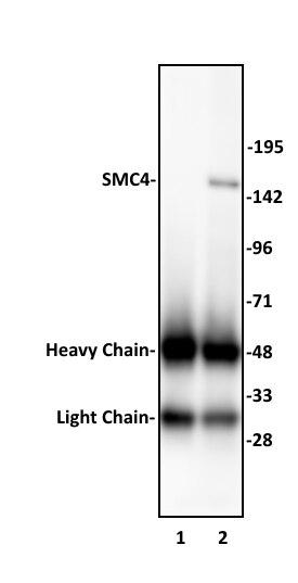 Smc4 SMC4 antibody (pAb) | Proteintech