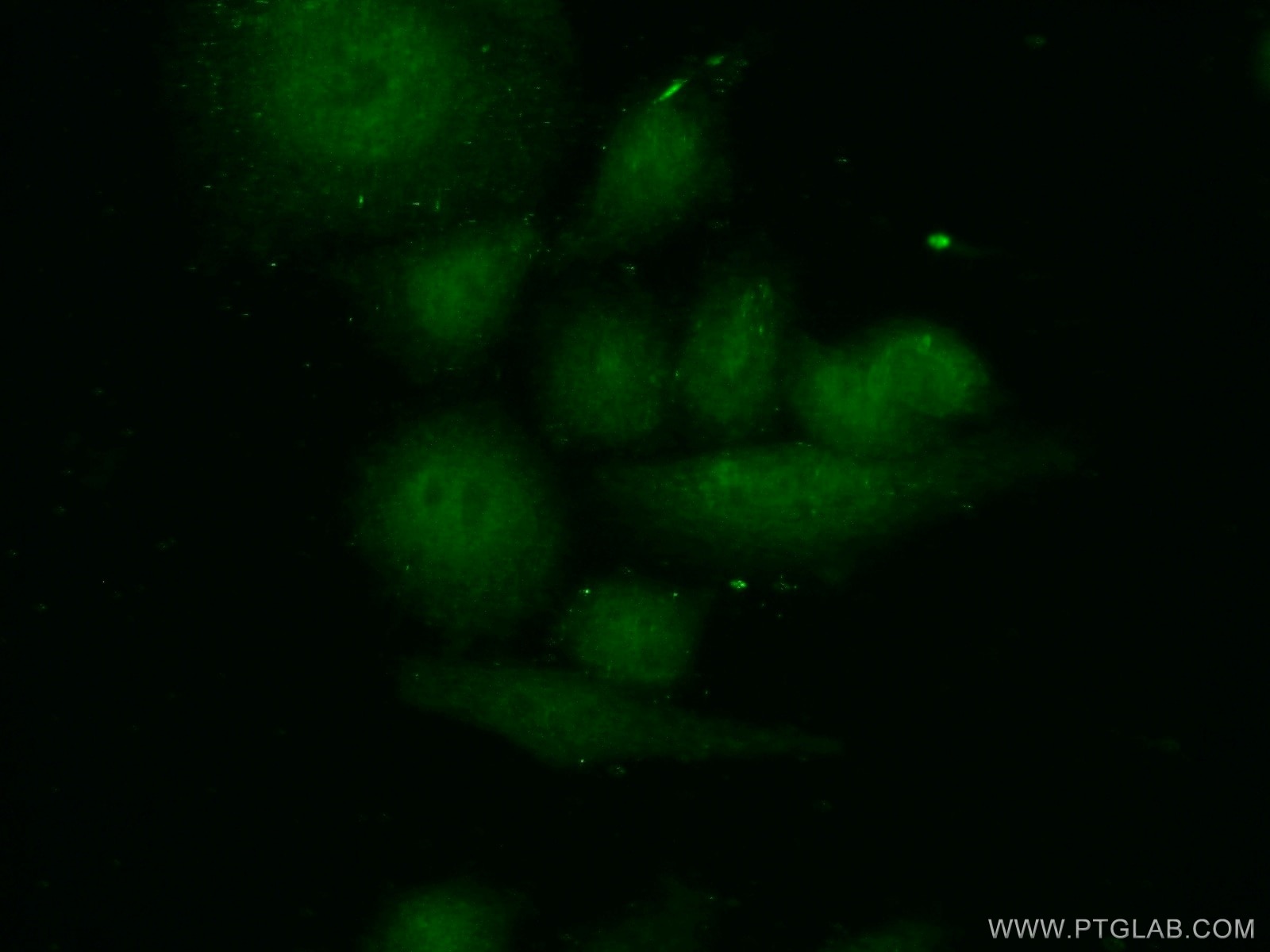 Immunofluorescence (IF) / fluorescent staining of HeLa cells using SMC5 Polyclonal antibody (14178-1-AP)