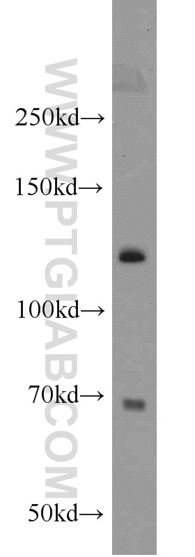 Western Blot (WB) analysis of HeLa cells using SMC5 Polyclonal antibody (14178-1-AP)