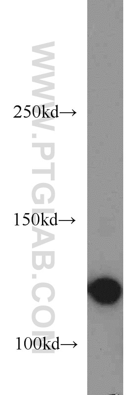 Western Blot (WB) analysis of HeLa cells using SMC5 Polyclonal antibody (14178-1-AP)