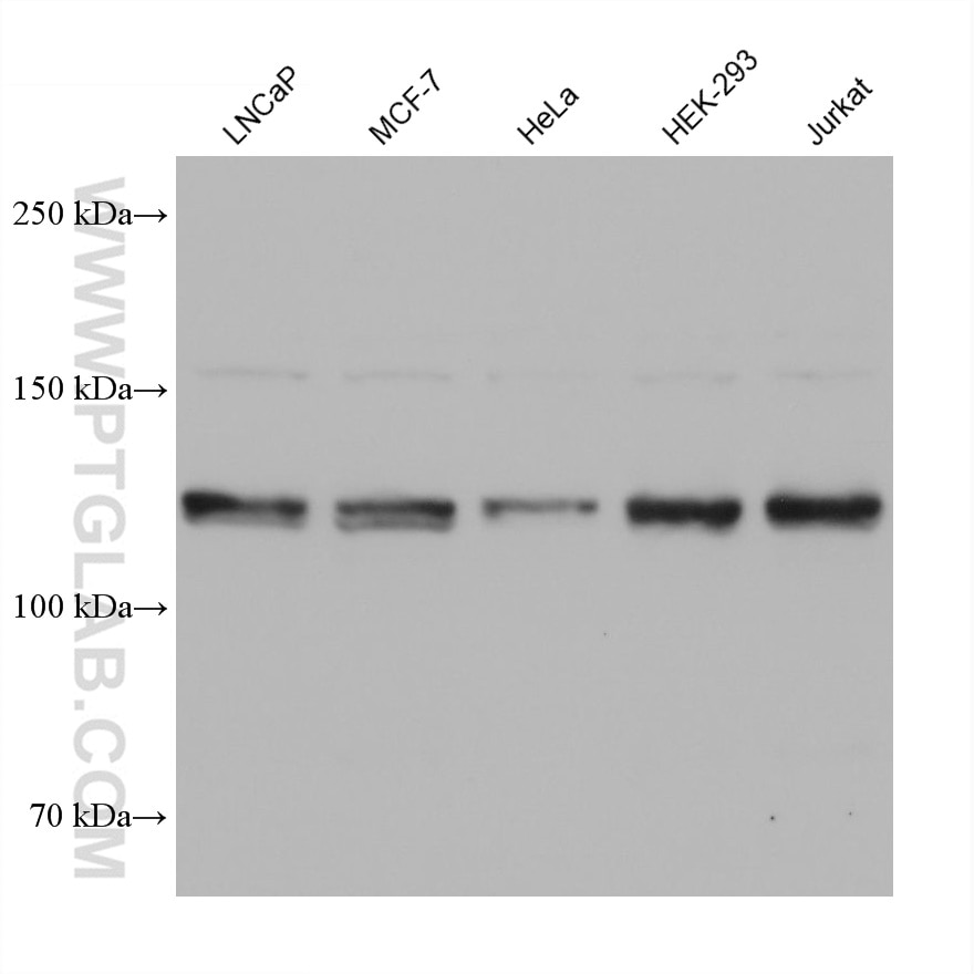 WB analysis using 68655-1-Ig