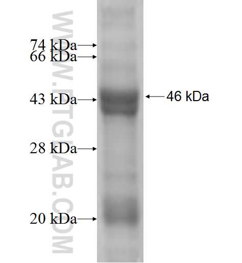 SMC5 fusion protein Ag5385 SDS-PAGE