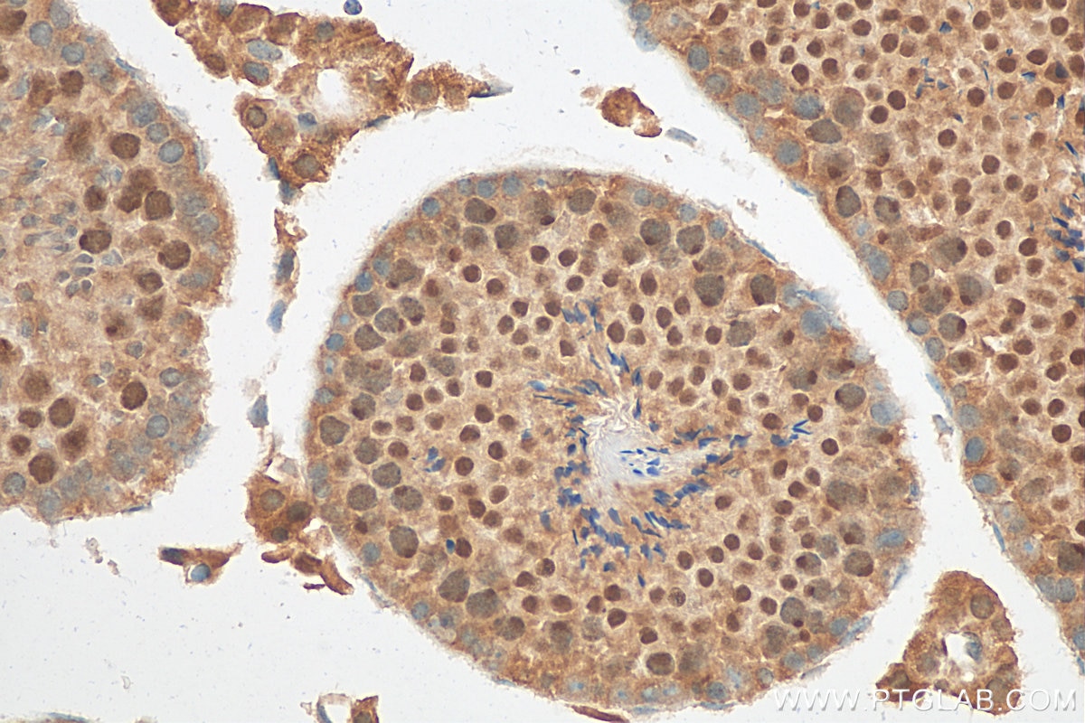 Immunohistochemistry (IHC) staining of mouse testis tissue using SMC6 Polyclonal antibody (14465-1-AP)