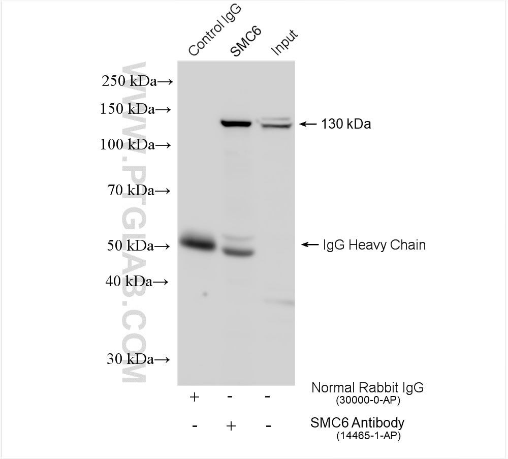 Immunoprecipitation (IP) experiment of HeLa cells using SMC6 Polyclonal antibody (14465-1-AP)