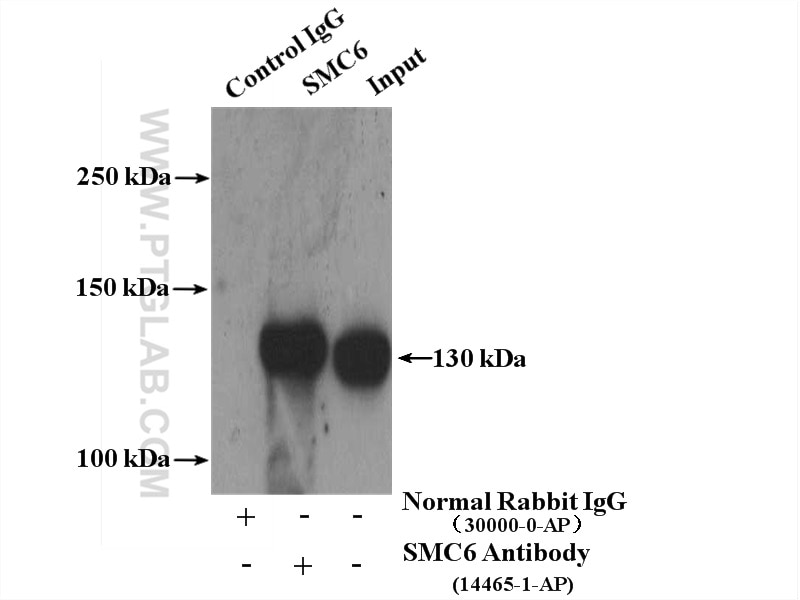 Immunoprecipitation (IP) experiment of mouse testis tissue using SMC6 Polyclonal antibody (14465-1-AP)