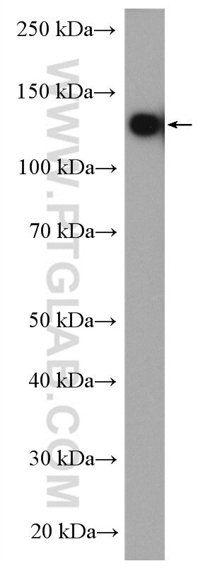 Western Blot (WB) analysis of mouse testis tissue using SMC6 Polyclonal antibody (14465-1-AP)