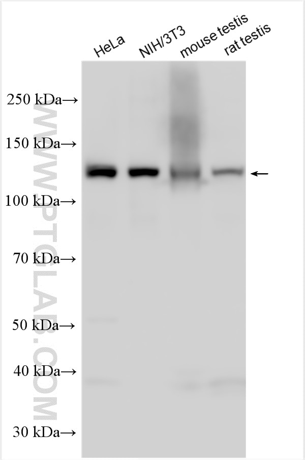 Western Blot (WB) analysis of various lysates using SMC6 Polyclonal antibody (14465-1-AP)