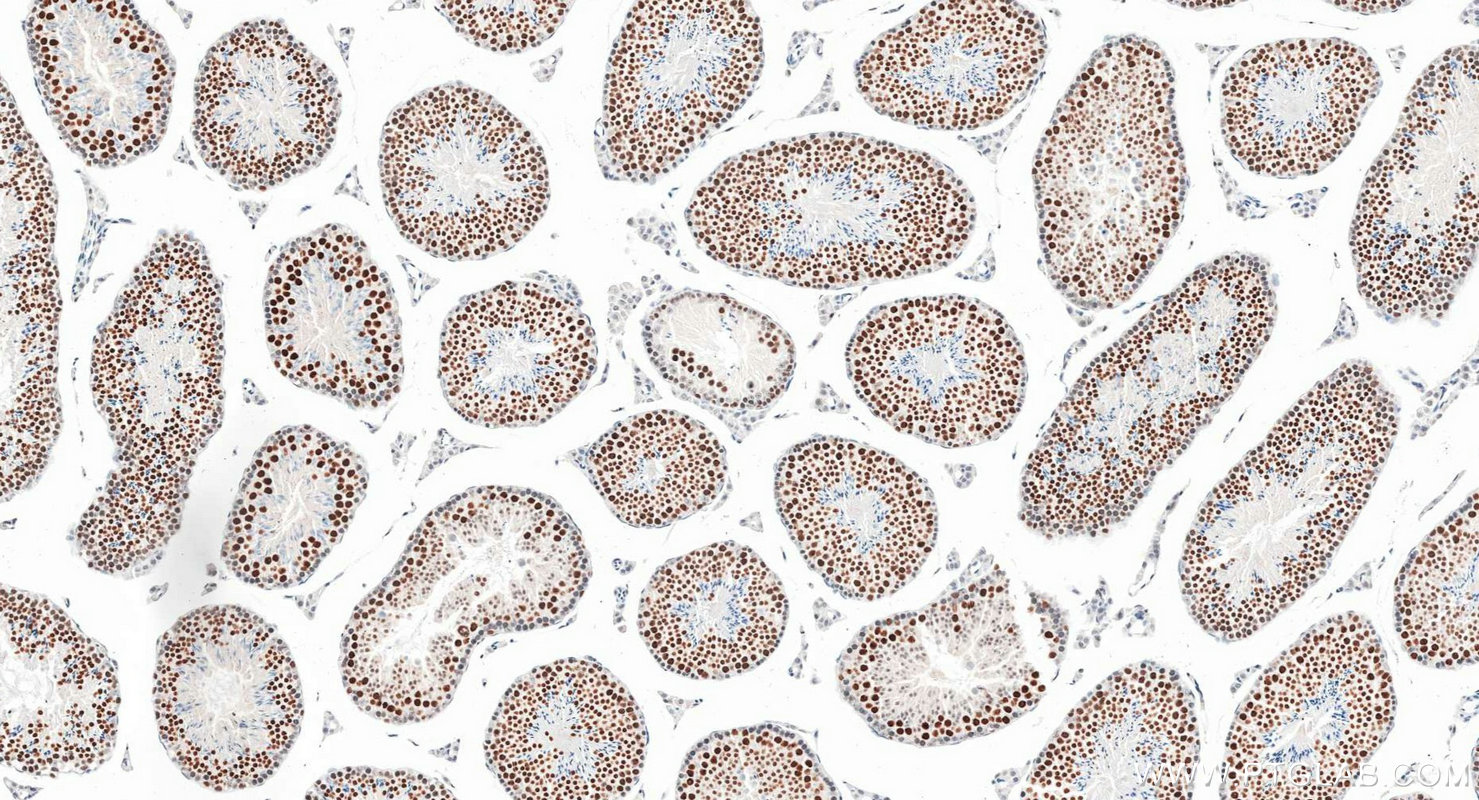 Immunohistochemistry (IHC) staining of mouse testis tissue using SMC6 Recombinant monoclonal antibody (83187-3-RR)