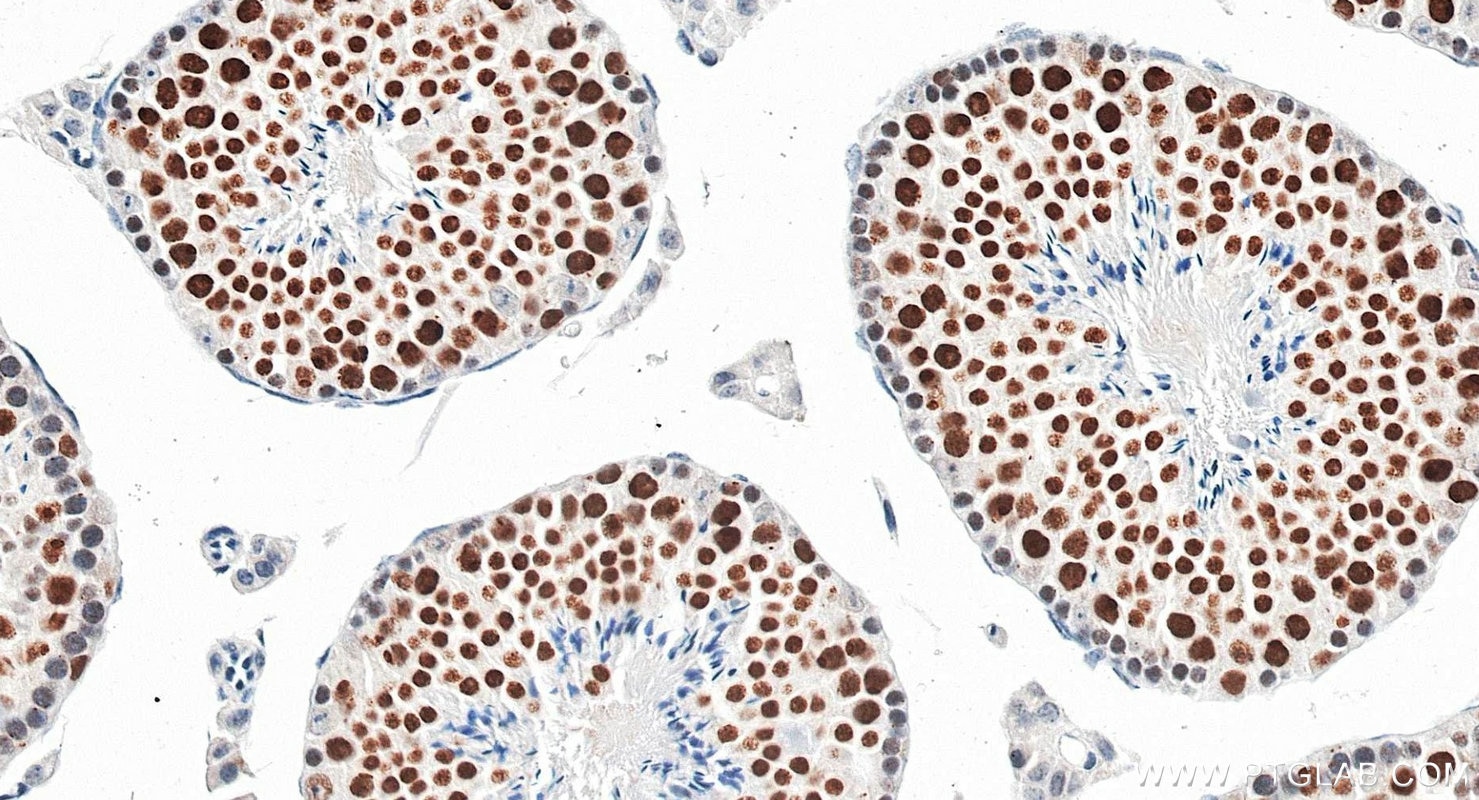 Immunohistochemistry (IHC) staining of mouse testis tissue using SMC6 Recombinant monoclonal antibody (83187-3-RR)