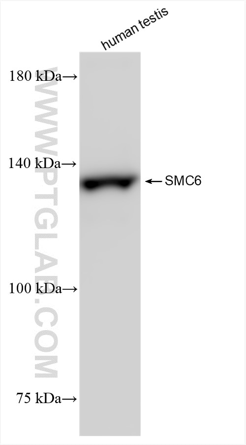 SMC6