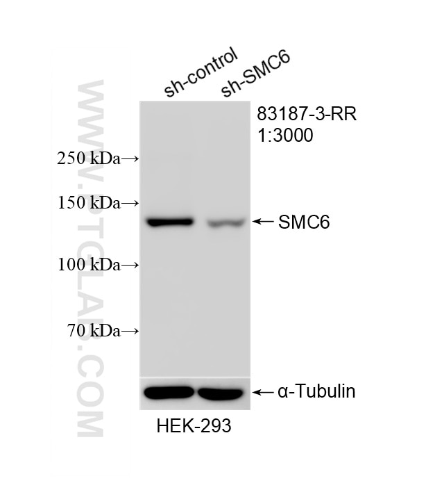 WB result of SMC6 antibody (83187-3-RR; 1:3000; incubated at room temperature for 1.5 hours) with sh-Control and sh-SMC6 transfected HEK-293 cells. This data was developed using the same antibody clone with 83187-3-PBS in a different storage buffer formulation. Western Blot (WB) analysis of HEK-293 cells using SMC6 Recombinant monoclonal antibody (83187-3-RR)