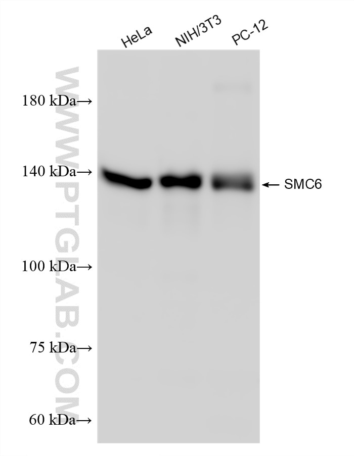 Western Blot (WB) analysis of various lysates using SMC6 Recombinant monoclonal antibody (83187-3-RR)