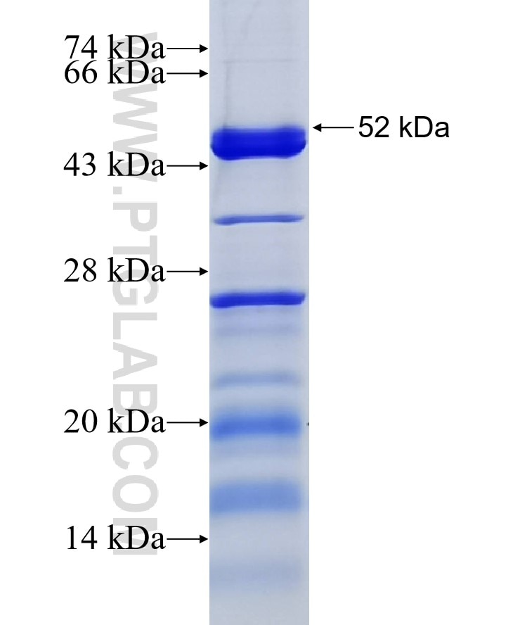 SMC6 fusion protein Ag6898 SDS-PAGE