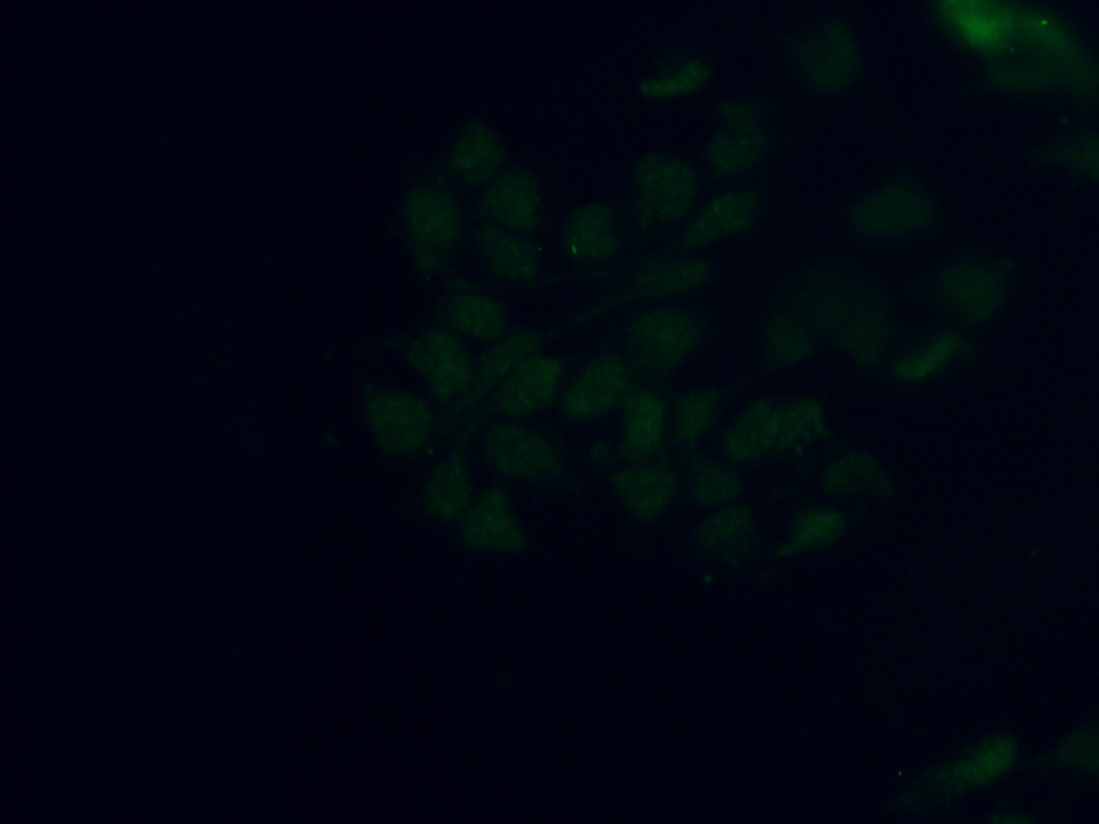 Immunofluorescence (IF) / fluorescent staining of HEK-293 cells using SMCHD1 Polyclonal antibody (25589-1-AP)