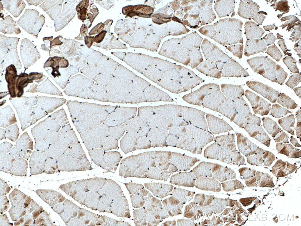 Immunohistochemistry (IHC) staining of mouse skeletal muscle tissue using SMCHD1 Polyclonal antibody (25589-1-AP)