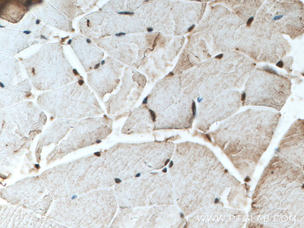Immunohistochemistry (IHC) staining of mouse skeletal muscle tissue using SMCHD1 Polyclonal antibody (25589-1-AP)