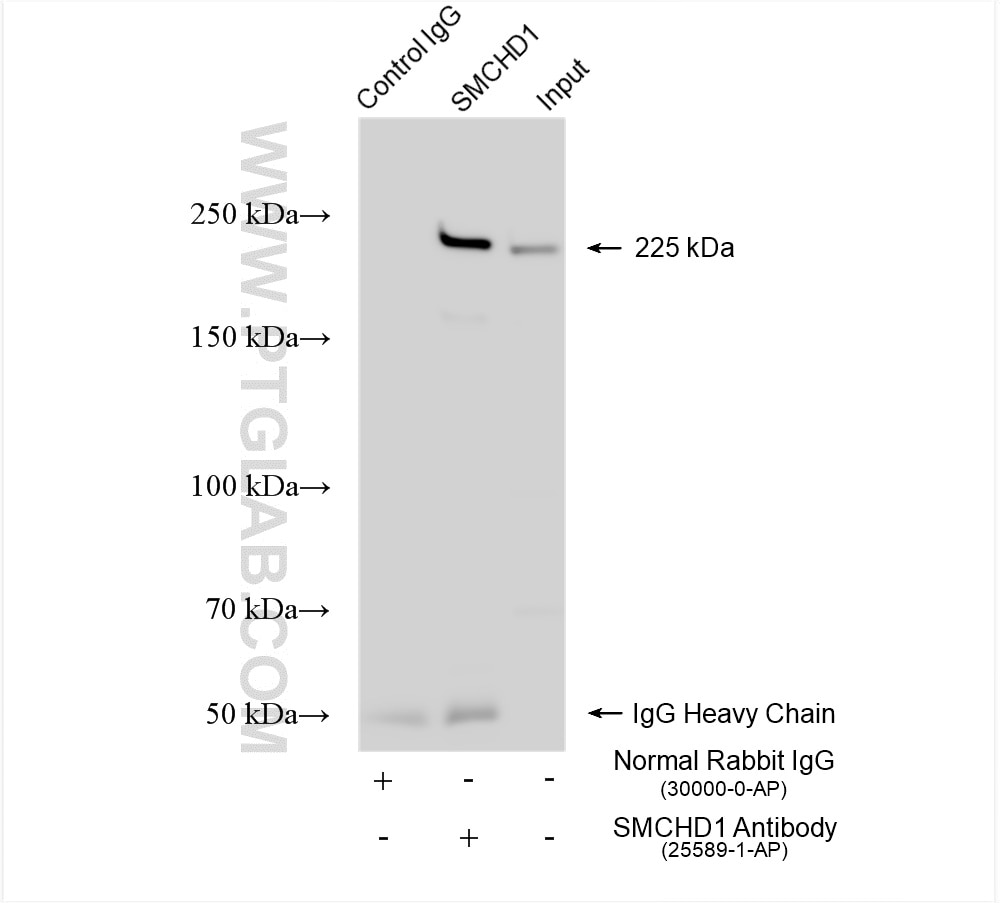 Immunoprecipitation (IP) experiment of HeLa cells using SMCHD1 Polyclonal antibody (25589-1-AP)