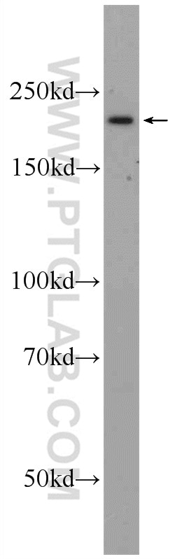Western Blot (WB) analysis of HeLa cells using SMCHD1 Polyclonal antibody (25589-1-AP)