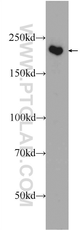 Western Blot (WB) analysis of HEK-293 cells using SMCHD1 Polyclonal antibody (25589-1-AP)