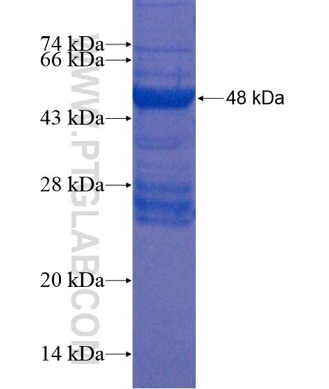 SMCHD1 fusion protein Ag22293 SDS-PAGE