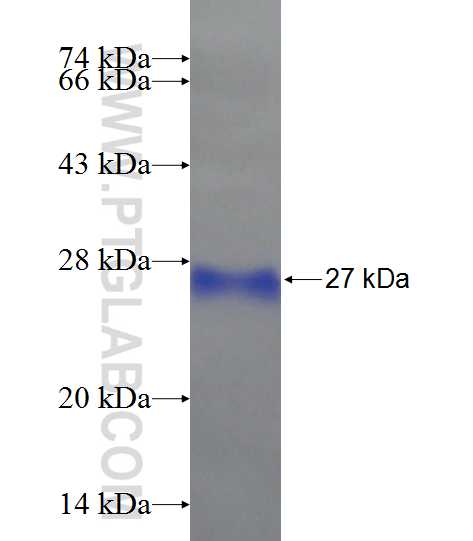 SMCHD1 fusion protein Ag22363 SDS-PAGE