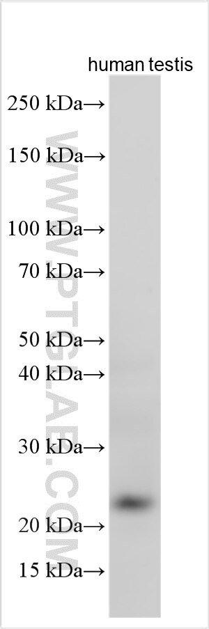 Various lysates were subjected to SDS PAGE followed by western blot with 13936-1-AP (SMCP antibody) at dilution of 1:4000 incubated at room temperature for 1.5 hours. Western Blot (WB) analysis of various lysates using SMCP Polyclonal antibody (13936-1-AP)