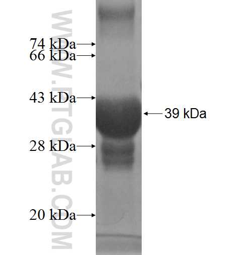 SMCP fusion protein Ag4984 SDS-PAGE