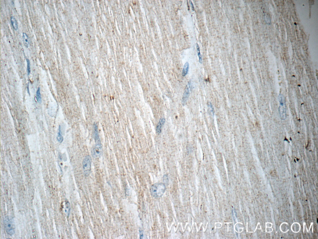 IHC staining of human skeletal muscle using 16413-1-AP