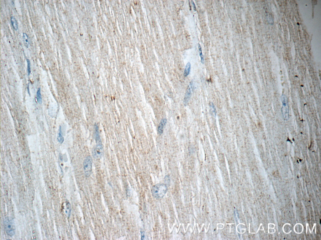 Immunohistochemistry (IHC) staining of human skeletal muscle tissue using SMCR7/MID49 Polyclonal antibody (16413-1-AP)