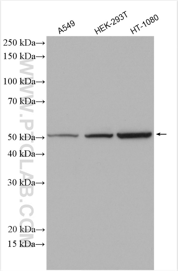 Western Blot (WB) analysis of various lysates using SMCR7L/MID51 Polyclonal antibody (20164-1-AP)