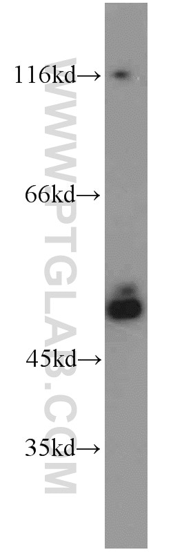 Western Blot (WB) analysis of NIH/3T3 cells using SMCR7L/MID51 Polyclonal antibody (20164-1-AP)