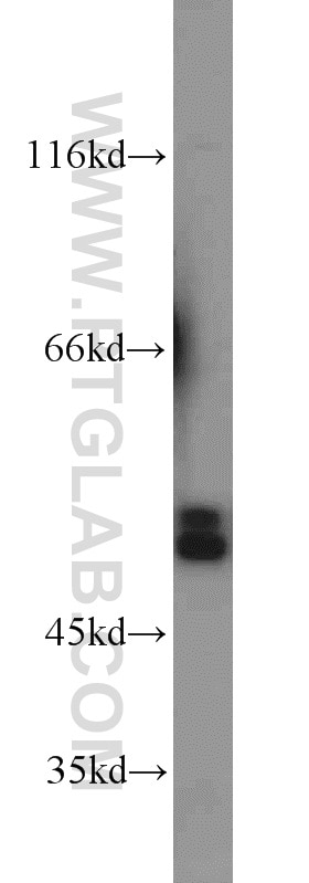 Western Blot (WB) analysis of mouse testis tissue using SMCR7L/MID51 Polyclonal antibody (20164-1-AP)