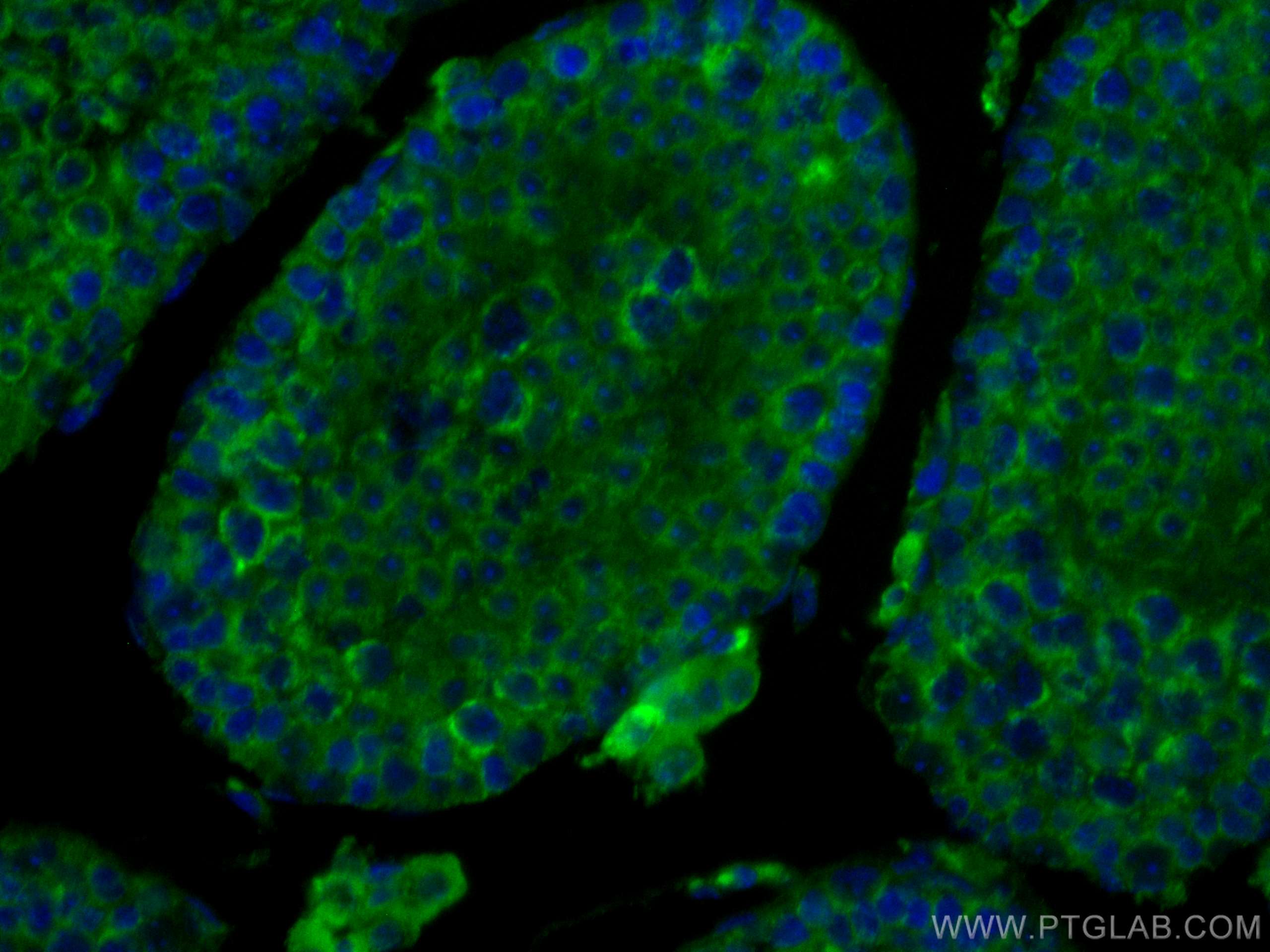 Immunofluorescence (IF) / fluorescent staining of mouse testis tissue using SMCR7L Monoclonal antibody (67808-1-Ig)