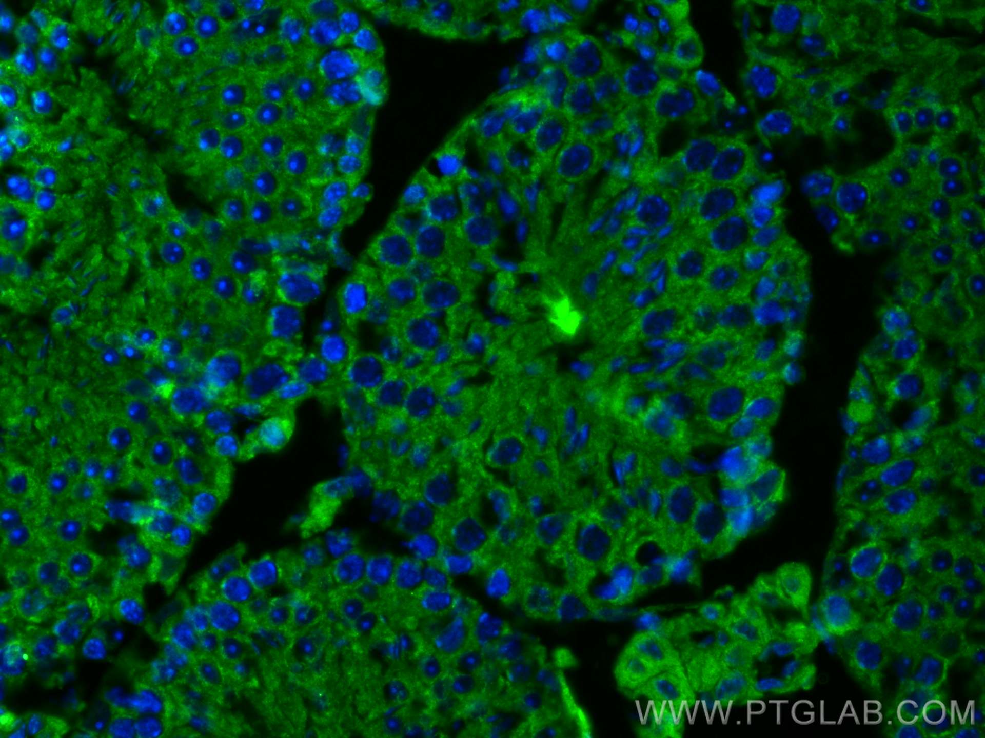 Immunofluorescence (IF) / fluorescent staining of mouse testis tissue using SMCR7L/MID51 Monoclonal antibody (67808-1-Ig)
