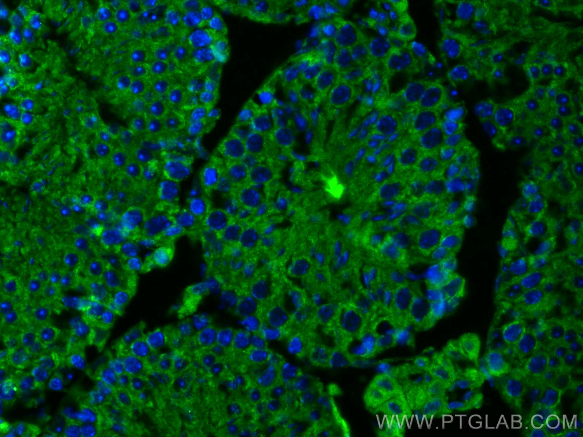 IF Staining of mouse testis using 67808-1-Ig