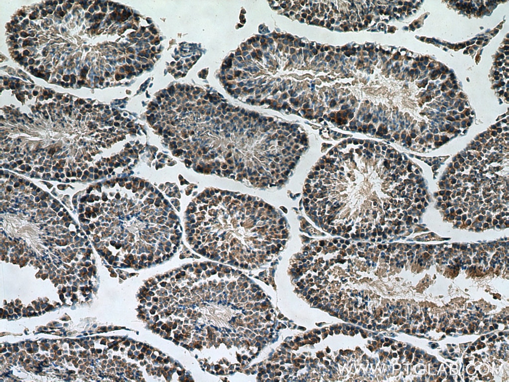 Immunohistochemistry (IHC) staining of mouse testis tissue using SMCR7L/MID51 Monoclonal antibody (67808-1-Ig)