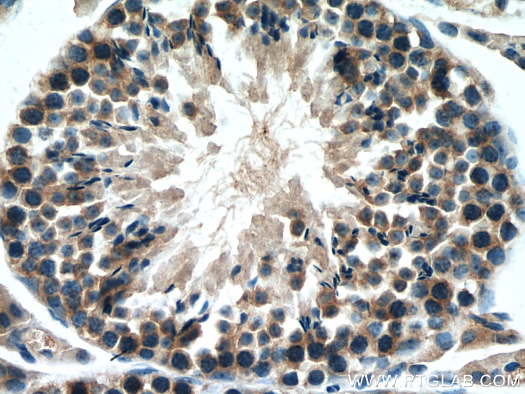 Immunohistochemistry (IHC) staining of mouse testis tissue using SMCR7L/MID51 Monoclonal antibody (67808-1-Ig)