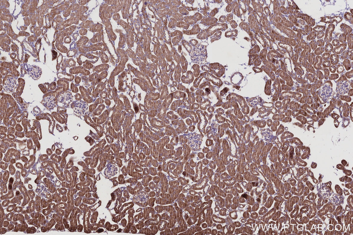 Immunohistochemistry (IHC) staining of mouse kidney tissue using SMCR7L/MID51 Monoclonal antibody (67808-1-Ig)