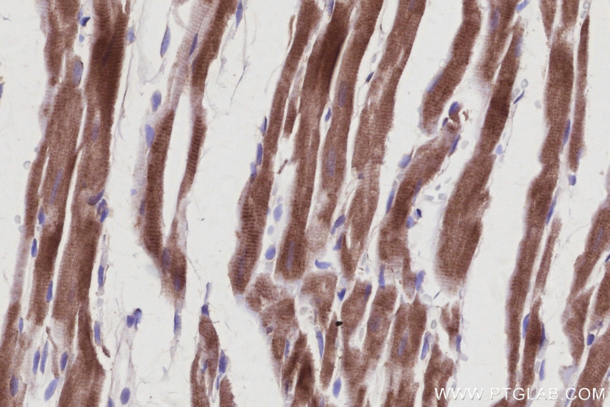 Immunohistochemistry (IHC) staining of rat heart tissue using SMCR7L/MID51 Monoclonal antibody (67808-1-Ig)