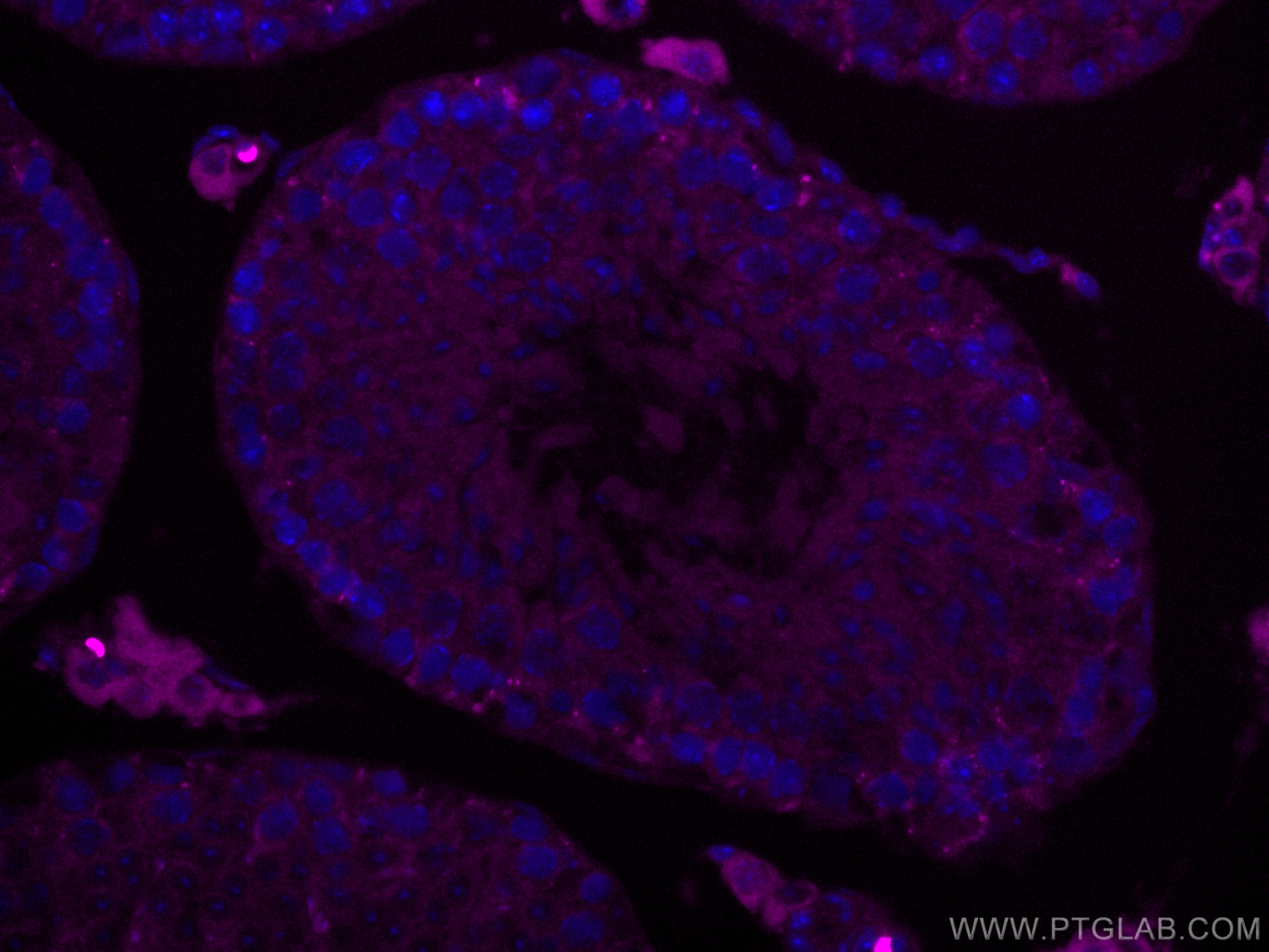 Immunofluorescence (IF) / fluorescent staining of mouse testis tissue using CoraLite® Plus 647-conjugated SMCR7L Monoclonal an (CL647-67808)