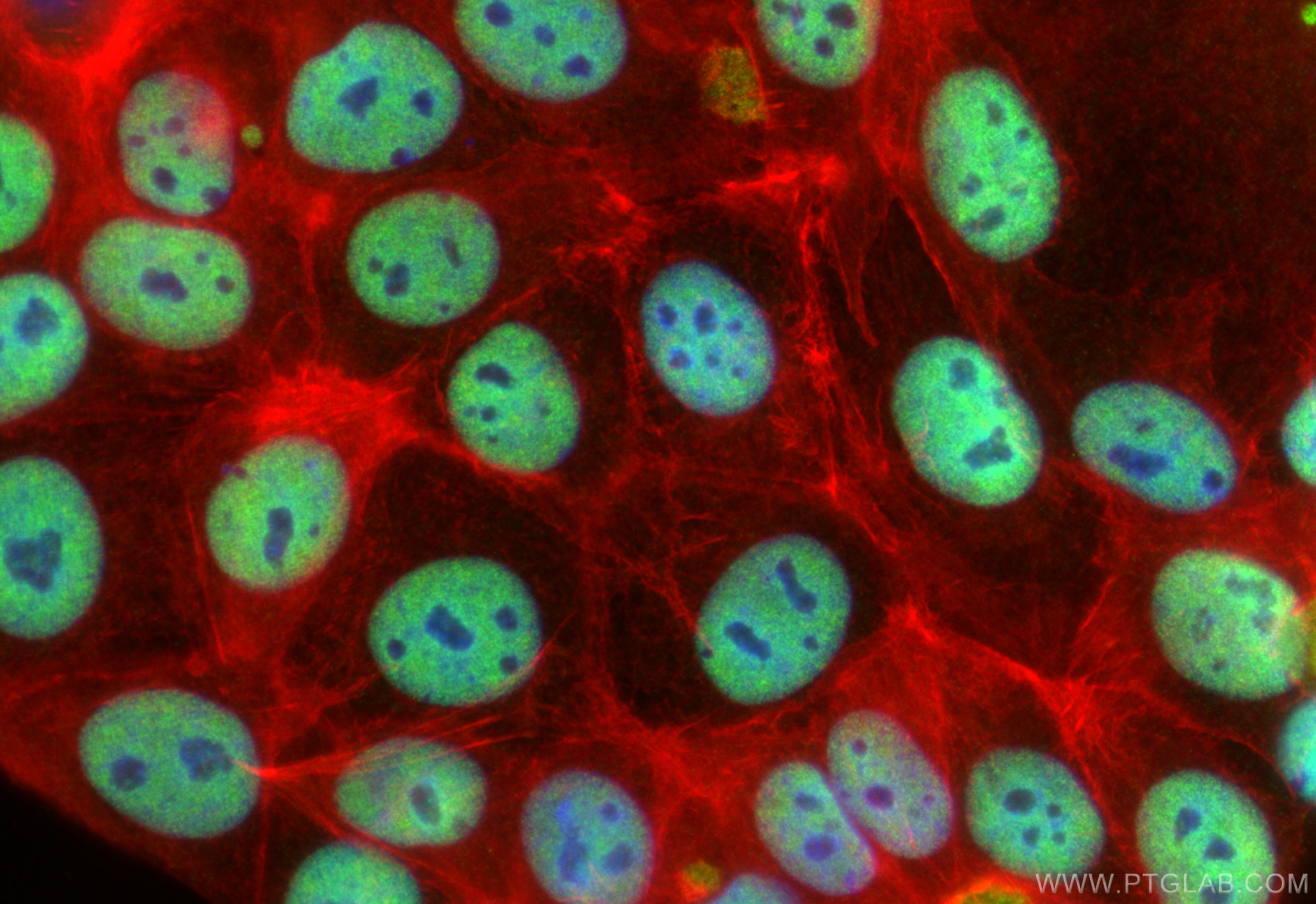 Immunofluorescence (IF) / fluorescent staining of MCF-7 cells using SMEK1 Polyclonal antibody (26153-1-AP)