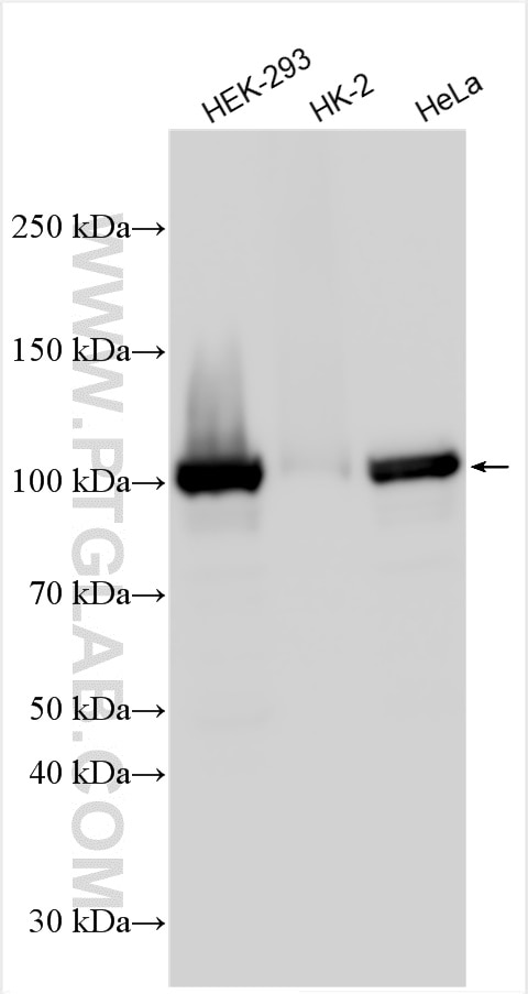 Western Blot (WB) analysis of various lysates using SMEK1 Polyclonal antibody (26153-1-AP)