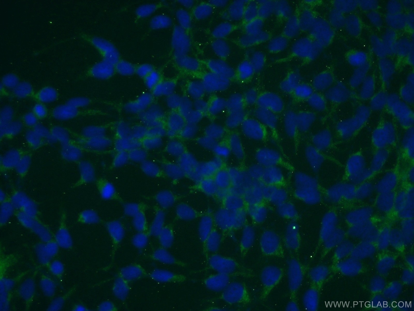 Immunofluorescence (IF) / fluorescent staining of HEK-293 cells using SMEK2 Polyclonal antibody (20348-1-AP)