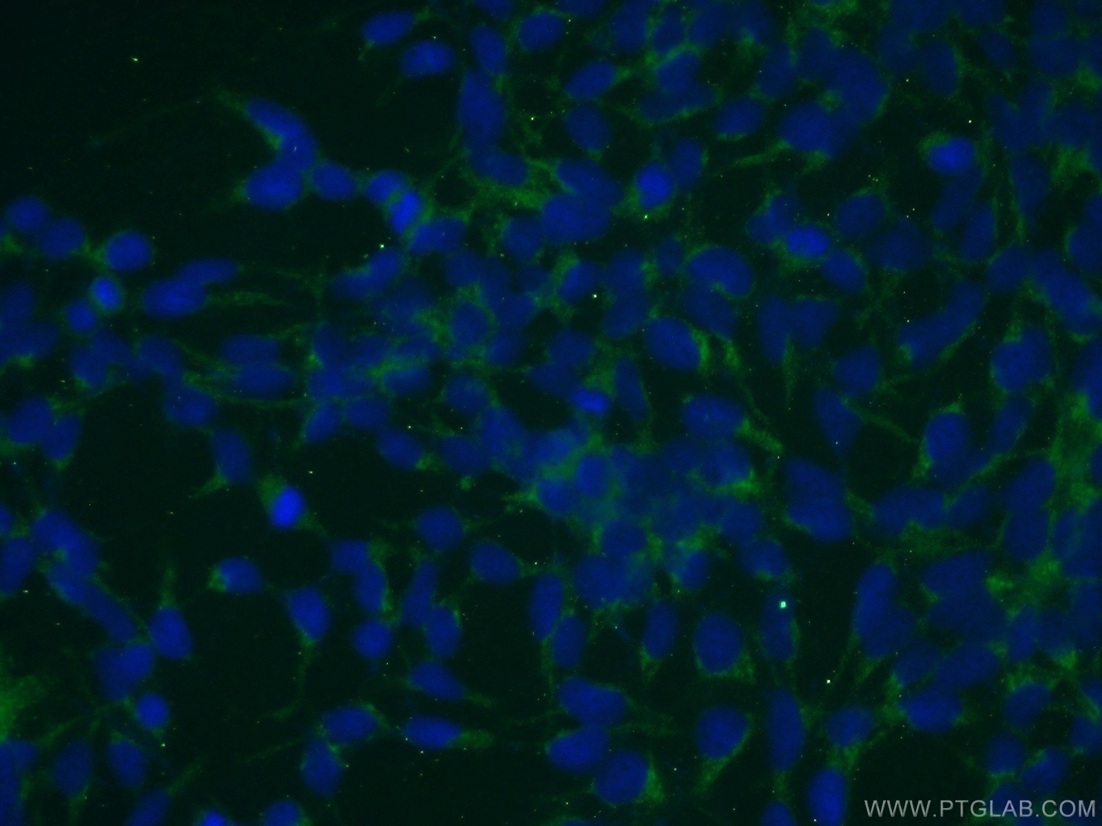 IF Staining of HEK-293 using 20348-1-AP