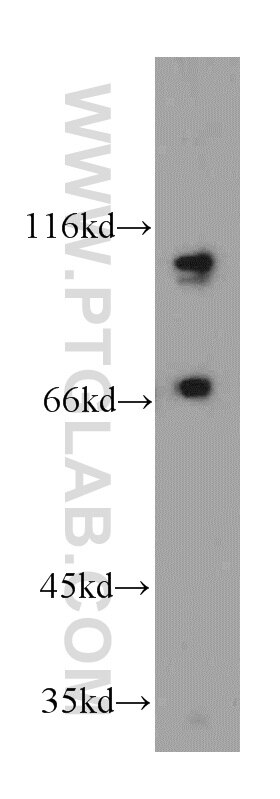 Western Blot (WB) analysis of HeLa cells using SMEK2 Polyclonal antibody (20348-1-AP)