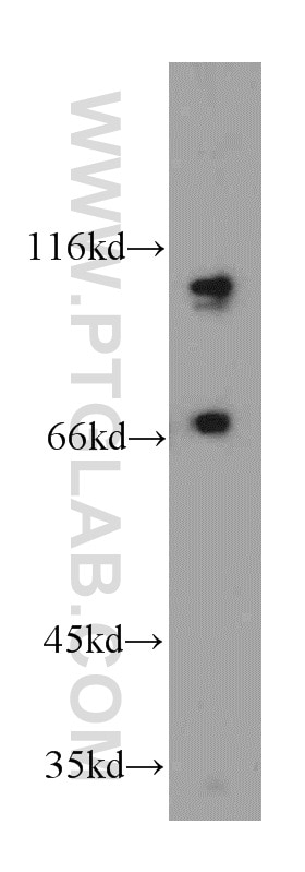 WB analysis of HeLa using 20348-1-AP