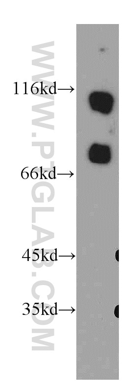 Western Blot (WB) analysis of MCF-7 cells using SMEK2 Polyclonal antibody (20348-1-AP)