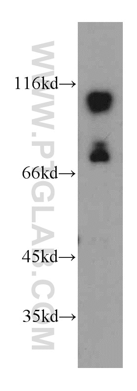 Western Blot (WB) analysis of HEK-293 cells using SMEK2 Polyclonal antibody (20348-1-AP)